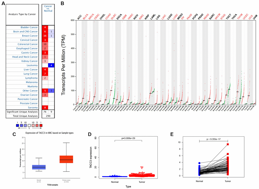 TACC3 expression in KIRC using online databases. (A) Oncomine database. Cell color is determined by the best gene rank percentile for the analyses within the cell. (B) GEPIA database. Significant differences were shown in red. (C) UALCAN database. pD) TCGA database using R script. p=3.008e-29. (E) TACC3 expression in a paired comparison of KIRC and their adjacent normal tissues. Data were extracted from TCGA database. p=9.355e-17.