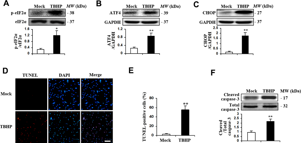 TBHP activated the expression of transcription factor ATF4 and induced apoptosis in HTMCs. HTMCs were exposed to media in the absence (Mock) or presence of 50 μM of TBHP for 12 h. (A–C) Western blot analysis for phospho-eIF2α, total eIF2α, ATF4, CHOP and GAPDH. Intensities were quantified and normalized against the level of total proteins (eIF2α) or GAPDH (mean ± SEM, n = 3). (D) Representative images of immunostaining for apoptotic (TUNEL-positive, red) HTMCs. Nuclei were labeled with DAPI (blue). Scale bar represents 100 μm. (E) Quantification of apoptotic nuclei by Image-Pro Plus software. Values are expressed as the percentage of TUNEL-positive cells to total (DAPI-positive) cells (mean ± SEM, n = 3). (F) Western blot analysis for cleaved caspase-3. Intensities were quantified and normalized against the level of total caspase-3 (mean ± SEM, n = 3). *P**P 