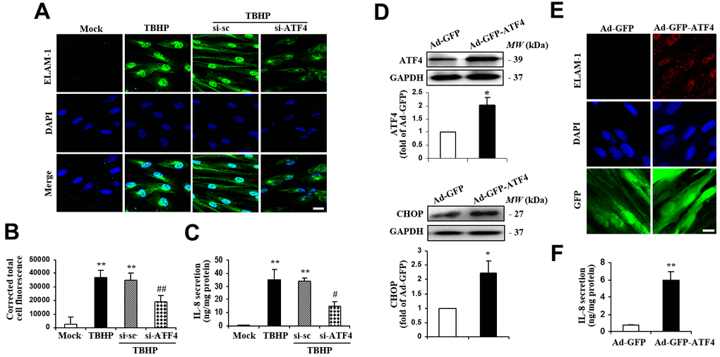ATF4 is an important mediator of ELAM-1 expression and IL-8 secretion in HTMCs. (A–C) HTMCs were exposed to media in the absence (Mock) or presence of 50 μM of TBHP for 12 h. Alternatively, cells were transfected with si-ATF4 or si-sc for 48 h, followed by incubation with 50 μM of TBHP for additional 12 h. (A) Representative images of subcellular expression of ELAM-1 as examined by indirect immunofluorescence (green, ELAM-1. blue, DAPI. scale bar, 40 μm). (B) Levels of cellular immunofluorescence of ELAM-1 were quantified and expressed as corrected total cell fluorescence (mean ± SEM, n = 3). (C) IL-8 secretion was assayed in culture supernatant of HTMCs using an IL-8 ELISA kit. Values were normalized for total protein at the respective treatment (mean ± SEM, n = 3). **P #P ##P D–F) A recombinant adenovirus coding ATF4 (Ad-GFP-ATF4) was constructed to express GFP protein as a marker for the identification of infected cells. Cultured HTMCs were infected with Ad-GFP-ATF4 or empty vector (Ad-GFP) for 72 h. (D) Western blot analysis for ATF4 and CHOP. Intensities of protein expression were quantified, normalized against the level of GAPDH and expressed as relative changes to Ad-GFP (mean ± SEM, n = 3). (E) Subcellular expression of ELAM-1 was detected by immunofluorescent staining (red, ELAM-1. blue, DAPI. green, GFP. scale bar, 20 μm). (F) IL-8 secretion was assayed using ELISA. Values were normalized for total protein at the respective treatment (mean ± SEM, n = 3). *P **P 