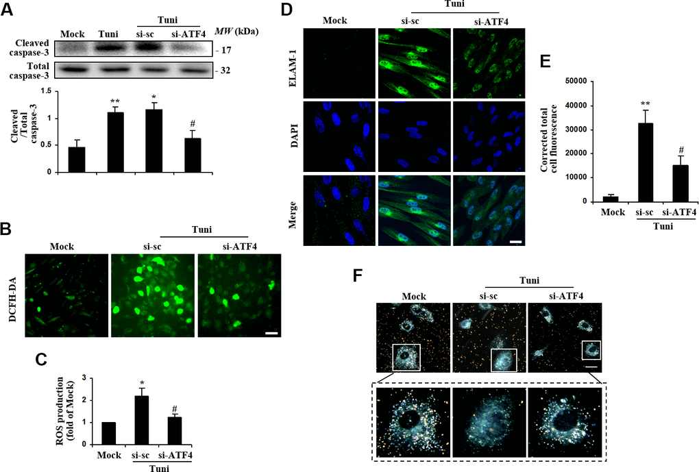 Suppression of ATF4 prevented tunicamycin-induced apoptosis and ROS generation, and rescued the phagocytotic activity of HTMC. HTMCs were exposed to media in the absence (Mock) or presence of 100 ng/ml of tunicamycin (Tuni) for 24 h. Alternatively, cells were transfected with si-ATF4 or si-sc for 48 h, followed by incubation with 100 ng/ml of tunicamycin (Tuni) for additional 24 h. (A) Expression of cleaved caspase-3 was determined by Western blot analysis and quantified by densitometry (mean ± SEM, n = 3). (B) Representative images of ROS production in cells incubated with DCFH-DA (green. scale bar, 60 μm). (C) Quantification of intracellular ROS production. Values are expressed as the fold increase from Mock in ROS content evaluated by fluorescence intensity (mean ± SEM, n = 3). (D) Representative images of subcellular expression of ELAM-1 by indirect immunofluorescence (green, ELAM-1. blue, DAPI. scale bar, 40 μm). (E) Levels of cellular immunofluorescence of ELAM-1 were measured and expressed as corrected total cell fluorescence (mean ± SEM, n = 3). (F) Phagocytosis of colloidal gold by HTMCs was examined by dark field microscope (gold, colloidal gold). Representative images were mounted in upper panels (scale bar, 20 μm). Lower panels show magnified images of individual cells. *P**P #P