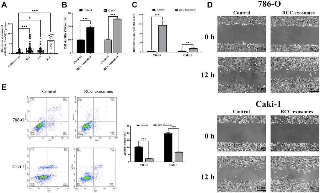 Characterization of RCC patient EVs and their impact on RCC cells. (A) RNA extracted from the RCC patient and healthy control EVs were subjected to qPCR analysis to evaluate the expression of miR-155. Levels of miR-155 increased in the RCC patient EVs. (B) The viability of 786-O or Caki-1 cells upon EV treatment was measured by CCK8 assay. RCC patient EVs increased cell viability. (C) The expression of miR-155 in 786-O or Caki-1 cells was determined by qRT-PCR after EV treatment. RCC patient EVs elevated miR-155 levels. (D) 786-O or Caki-1c cells were used in a wound-healing migration assay in the presence of different EVs. The migrated cells were observed under a microscope for 12 h. RCC patient EVs enhanced cell migration. (E) The apoptosis of 786-O or Caki-1 was measured by flow cytometry, revealing that RCC patient EVs significantly inhibited apoptosis. This experiment was conducted using three distinct biological replicates. *P **P ***P 