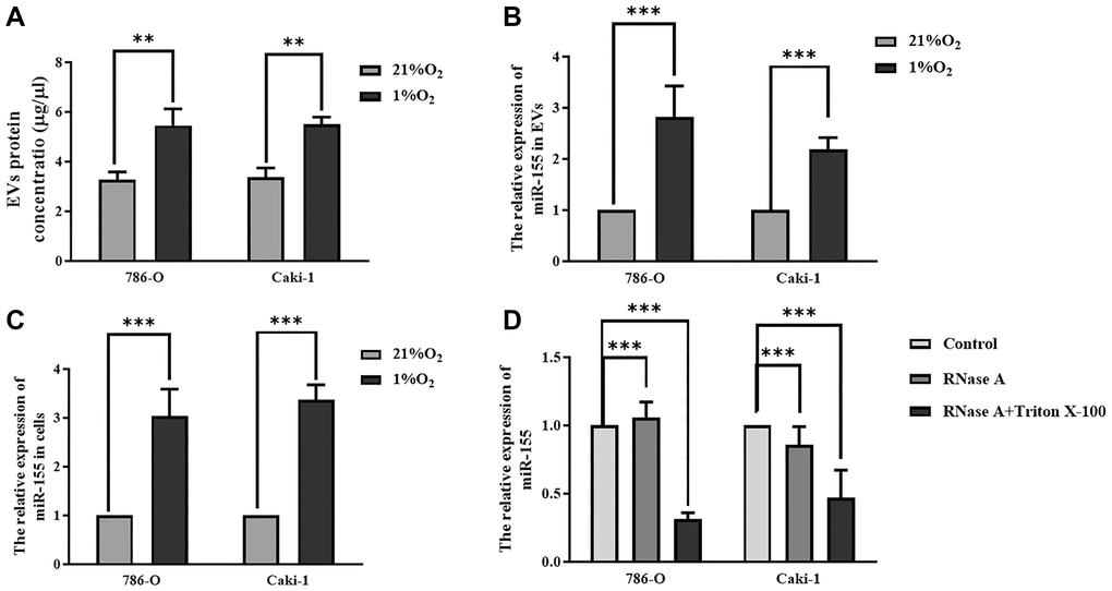 Hypoxia impacts miR-155 expression in RCC cell-derived EVs. (A) Hypoxia alters EV protein contents. (B, C) The impact of hypoxia on miR-155 expression in EVs (B) and cells (C). Hypoxia significantly increased protein contents in EVs. (D) miR-155 encapsulation within EVs was confirmed using RNase A and Triton X-100. The results confirmed that miR-155 is present primarily within EVs. This experiment was conducted using three distinct biological replicates. **P ***P 