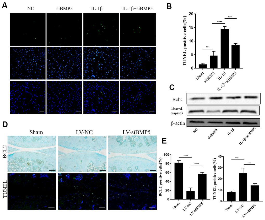 BMP5 silencing protects against chondrocyte apoptosis in both in vivo and in vitro OA models.  (A) Representative images show TUNEL staining assay in control and BMP5 knockdown murine chondrocytes treated with IL-1β. Scale bar: 5μm. (B) Quantitative analysis shows the total numbers of TUNEL-positive control and BMP5 knockdown chondrocytes treated with IL-1β. (C) Representative western blot images show BCL2 and cleaved-caspase3 protein levels in control and BMP5 knockdown chondrocytes treated with IL-1β. (D) Representative images and (E) quantitative analyses show TUNEL staining and BCl-2 immunohistochemical staining results in the knee articular cartilage tissues from sham-operated, DMM plus LV-siNC, and DMM plus LV-siBMP5 groups of mice at 4 weeks post-DMM operation. Scale bar: 5μm. All data are represented as the means ± SD (n=5); Scale bars: 5μm.