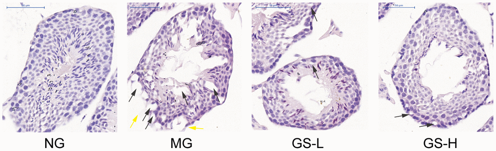 Effects of GSLS on histological changes in testes of D-gal-induced mice. Representative images at 400× magnification; bar indicates 50 μm. Black arrow head: Sertoli cell vacuolization. Yellow arrow head: interrupted basement membrane. n=3 per group. NG: normal group, MG: D-gal model group, GS-L: D-gal + low dosage of GSLS group, GS-H: D-gal + high dosage of GSLS group.