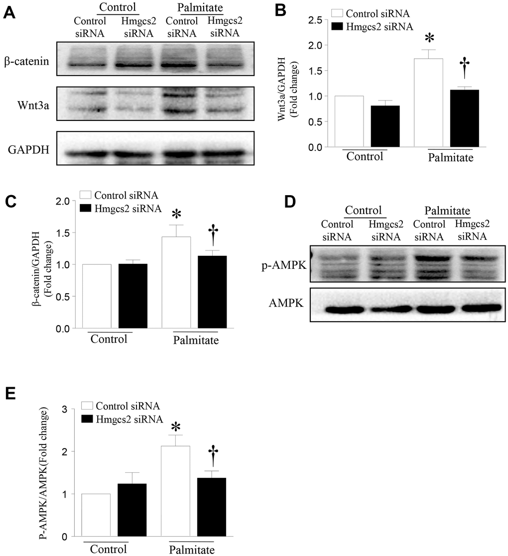 HMGCS2 regulates Wnt3a/β-catenin signal transduction and AMPK phosphorylation in HepG2 cells. Cultured HepG2 cells were transfected with Hmgcs2 siRNA or control siRNA, followed by incubation with high palmitate or oleate for 24 h. (A) Representative western blot for Wnt3a/β-catenin. (B, C) Quantification of Wnt3a/β-catenin protein levels relative to GAPDH from three different cultures. (D) Representative western blot for p-AMPK in mouse liver. (E) Quantification of p-AMPK protein levels relative to total AMPK. Data are presented as mean ± SD, n = 3. * P P 