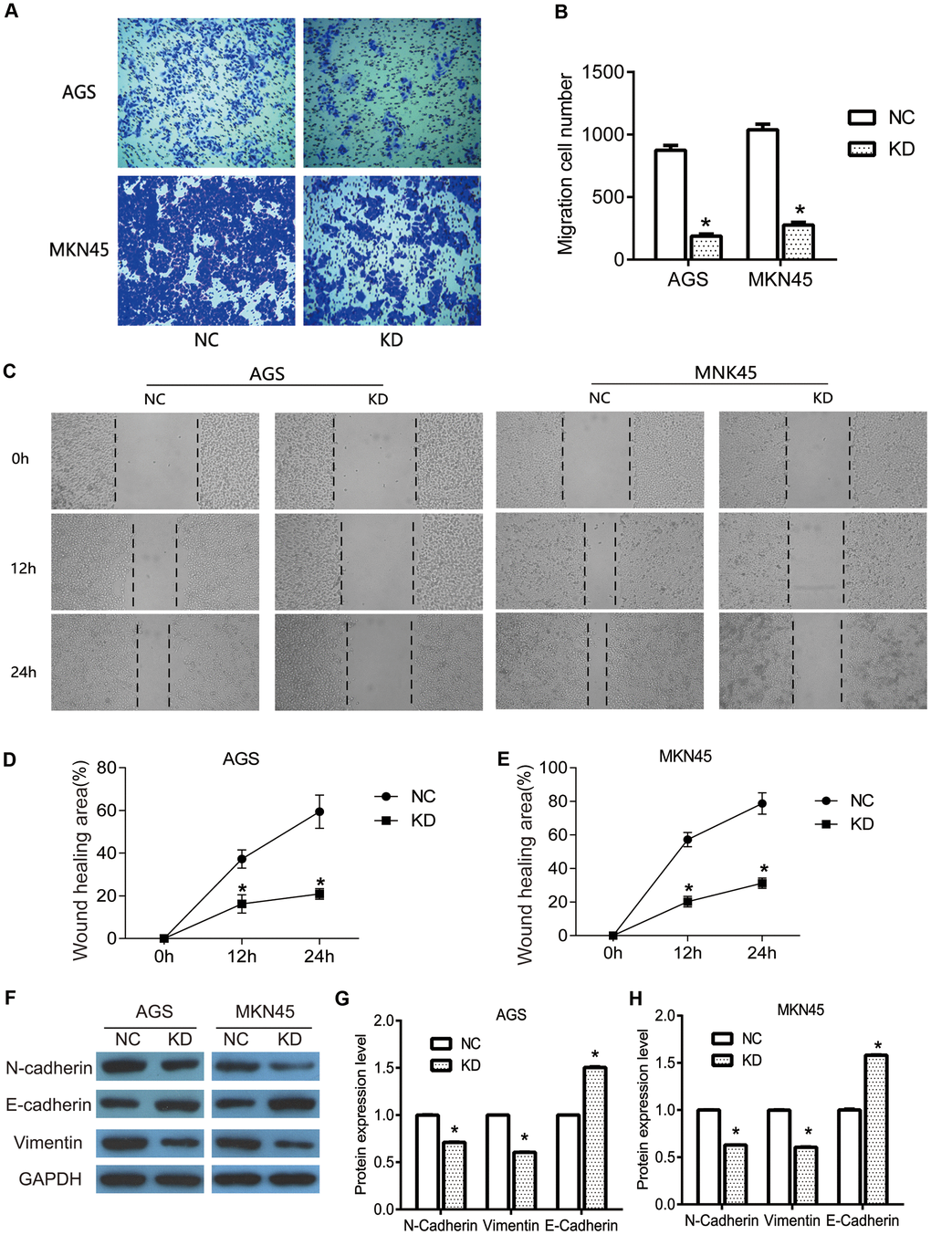 The knockdown of OGFRP1 inhibited the migration in human gastric cancer cells. (A) The migrations of AGS and MKN45 cells with the transfection of control siRNA or OGFRP1 specific-siRNA were evaluated by transwell. (B) Statistical analysis of migration cell number was performed using the t-test. (C) Wound healing assay was performed to further confirm the migration of AGS and MKN45 cells. The healing speed of scratches was calculated by healing area after scratching for 48 h/ total scratch area. (D) Statistical analysis of AGS cells was performed using the t-test. (E) Statistical analysis of MKN45 cells was performed using the t-test. (F) The expressions of migration-related proteins were determined using western blot. Statistical analyses of protein expression levels in AGS (G) and MKN45 (H) cells were performed using the t-test. *P