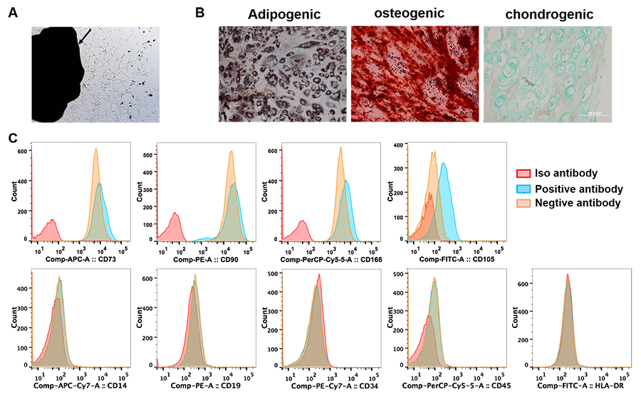 Identification of lung cancer-associated mesenchymal stem cells. (A) Tissue block culturing method was used to isolate MSCs from matched primary lung cancer and adjacent tumor-free tissues. Arrow, lung cancer tissue. (B) Adipogenic, osteogenic and chondrogenic differentiation was induced in MSCs in vitro. (C) The expression of surface markers of MSCs was tested by cytometry flow. (A–C) were representative results from LC-MSCs of one patient. LC-MSCs, lung cancer-associated mesenchymal stem cells.