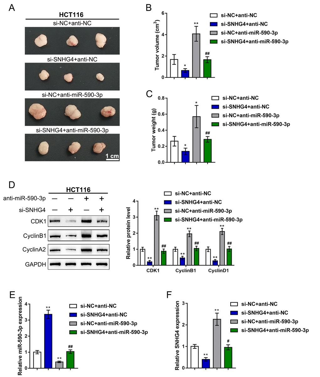 In vivo effects of the SNHG4/miR-590-3p axis on subcutaneously transplanted tumor growth. A subcutaneous transplantation tumor model was established in nude mice, and the mice were divided into four groups: si-NC + anti-NC group, si-SNHG4 + anti-NC group, si-NC + anti-miR-590-3p group, and si-SNHG4 + anti-miR-590-3p group. The mice received subcutaneous injections according to their group. (A–C) At day 35 of injection, the tumor size (A) was measured, the tumor volume (B) was calculated, and the tumor weight (C) was measured. (D) The protein levels of CDK1, cyclinB1, and cyclinA2 in the tumor samples were determined by immunoblotting. (E) The expression level of miR-590-3p was determined by PCR assay. (F) The expression level of SNHG4 was detected by PCR assay. *P **P ##P 
