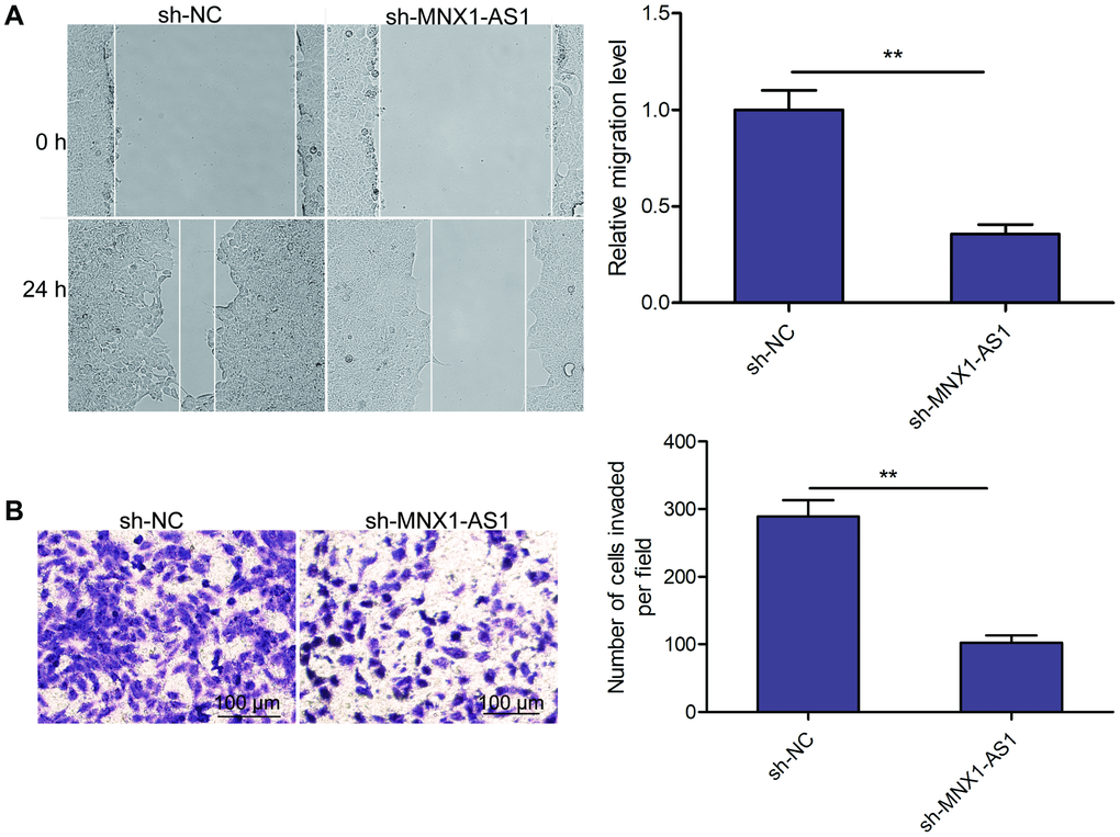 Knockdown of MNX1-AS1 inhibits LSCC cell migration and invasion. (A) Wound healing analysis of cell migration in TU212 cells transfected with sh-NC and sh-MNX1-AS1. (B) Transwell invasion analysis of cell invasion in TU212 cells transfected with sh-NC and sh-MNX1-AS1. *P **P 