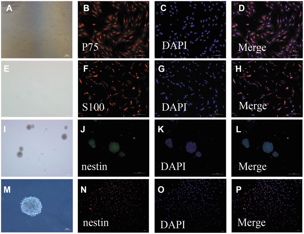 Identification of OECs and NSCs: (A–H): Phenotypic characterization of OECs: The appearance of OECs observed by phase-contrast microscopy (a: scale bar: 100 μm, e: scale bar: 50 μm). Immunofluorescent staining showed P75-positive cells (B–D): scale bar: 100 μm) and S100-positive cells (F–H): scale bar: 100 μm), which demonstrated that these cells were OECs. (I–P): Phenotypic characterization of NSCs: The appearance of NSCs observed by phase-contrast microscopy (i: scale bar: 100 μm, m: scale bar: 50 μm). Immunofluorescent staining of NSCs using nestin antibody (F–H): scale bar: 100 μm). The neurospheres were positive for nestin, suggesting that they were NSCs. Single-cell immunofluorescent staining of NSCs expressing nestin (N–H): scale bar: 100 μm). The purity of NSC cells was evaluated by the percentages of nestin-positive cells and DAPI-positive cells.