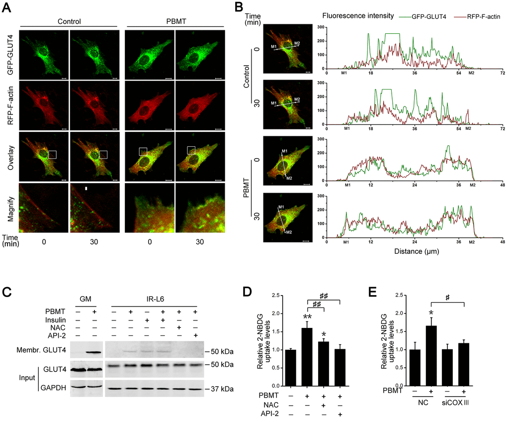 Activation of AKT signaling promotes glucose transporter GLUT4 translocation after PBMT. (A, B) Representative images (A) of GFP-GLUT4 (green) subcellular localization (red, RFP-F-actin) were obtained in IR-L6 myotubes treated with or without 8 J/cm2. The red areas of the RFP-F-actin images show the cell contour. Fluorescence intensity (B) of GFP-GLUT4 and RFP-F-actin along the white lines in fluorescence images of IR-L6 myotubes. M1 and M2 are cell boundaries. Scale bar, 10 μm. (C) Immunoblot analysis of GLUT4 in the cell membrane fraction of fresh GM and IR-L6 myotubes 30 min after 8 J/cm2 PBMT or 10 nM insulin treatment. Cells were pre-cultured with NAC (250 μM) or API-2 (2 μM) 1 hour before PBMT. (D) 2-NBDG uptake in IR-L6 myotubes 30 min after PBMT in the presence of either NAC or API-2. Mean ± SD, n = 3. *p p vs. the PBMT-untreated group; ##p vs. the indicated group (Student’s t-test). (E) 2-NBDG uptake in IR-L6 myotubes transfected with NC or COXIII siRNA 30 min after the indicated treatments. Mean ± SD, n = 3. *p vs. the PBMT-untreated group; #p vs. the indicated group (Student’s t-test).