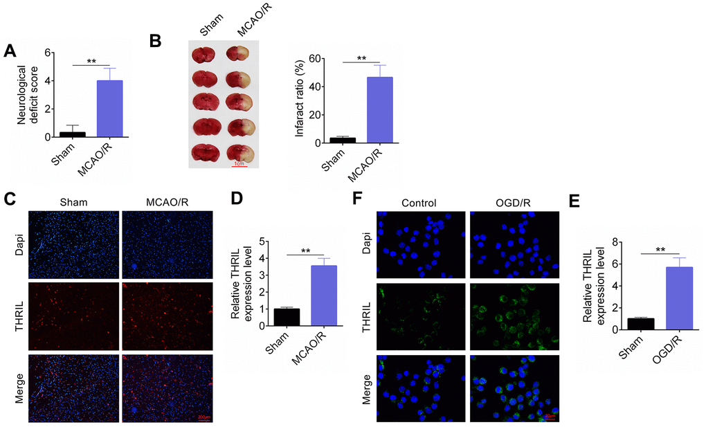 LncRNA THRIL is up-regulated in vitro and in vivo models of brain I/R injury. (A) The neurological deficit score. (B) The infract ratio. (C) Fluorescent immunostaining assay was performed in vivo models. (D) RT-qPCR assay detected lncRNA THRIL expression in vivo models. (E) Fluorescent immunostaining assay in vitro model. (F) RT-qPCR assay detected lncRNA THRIL in vitro model. Data are shown as mean ± SD for three-independent experiments. **P 