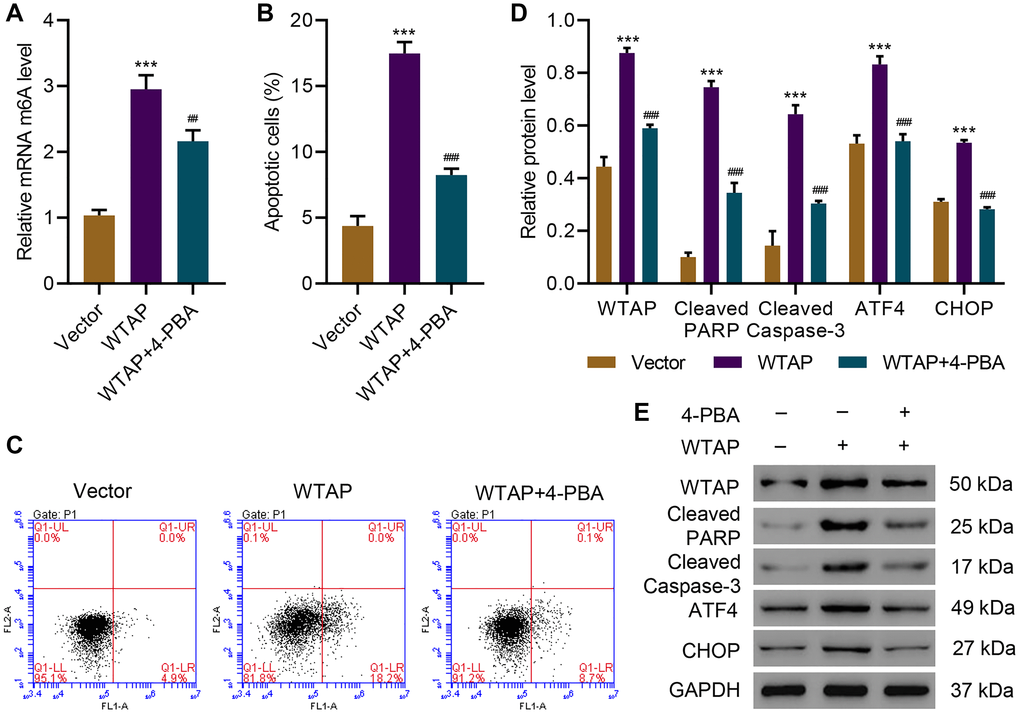 4-PBA protects AC16 cells from apoptosis and endoplasmic reticulum stress induced by WTAP overexpression. (A) The m6A levels in AC16 cells transduced with WTAP-overexpressing plasmid and treated with 2 mM 4-PBA for 48 h were measured by ELISA. (B, C) Cell apoptosis and (D, E) expression of WTAP, PARP, cleaved Caspase-3, ATF4 and CHOP. All experiments were repeated at least three times, and data are represented as mean ± SD. ***P ##P ###P 