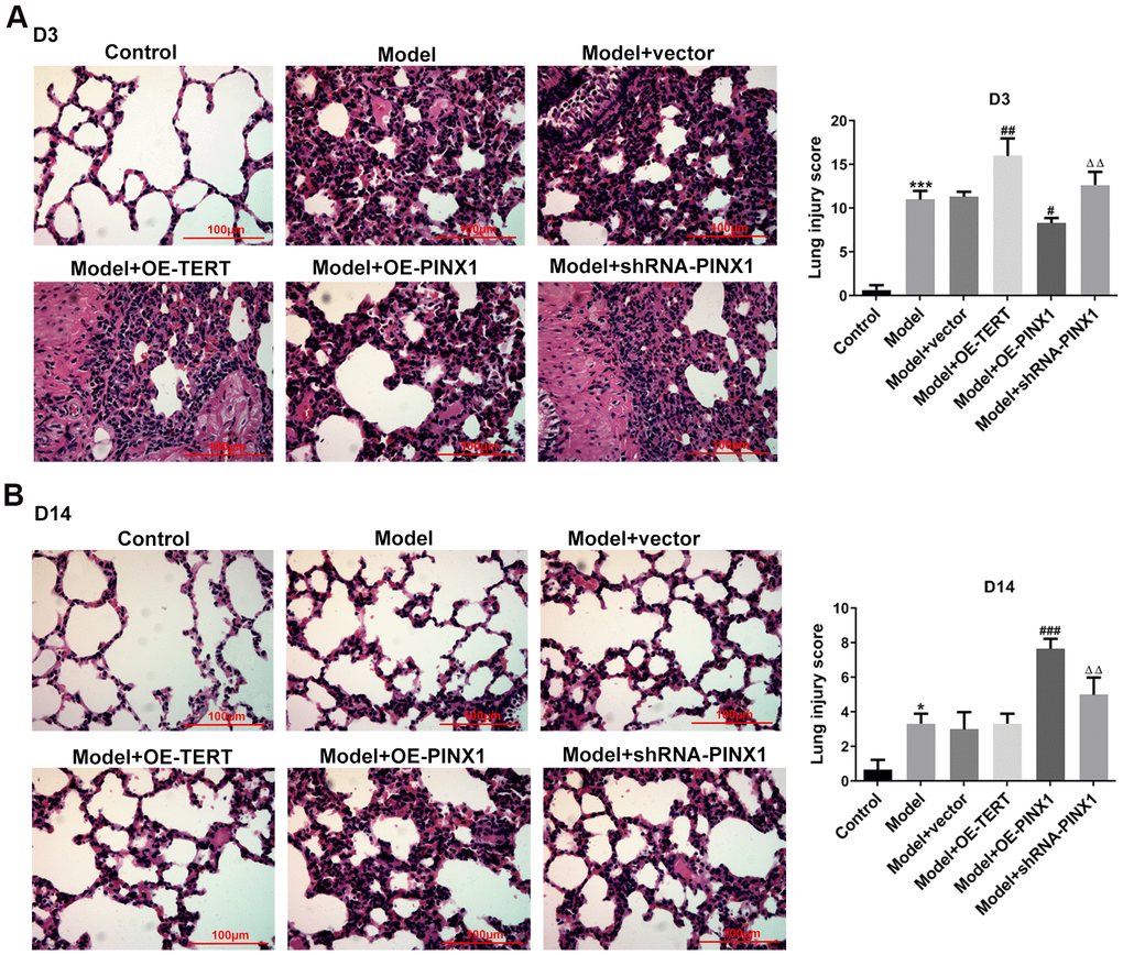 TERT overexpression, PINX1 silencing, and PINX1 overexpression presented different effects on pathological changes of lung tissue on D3 and D14 in LPS-induced lung injury rats. The histopathological changes in lung tissues on (A) D3 and (B) D14 were evaluated using H&E staining. *P***P#P##P###PΔΔP