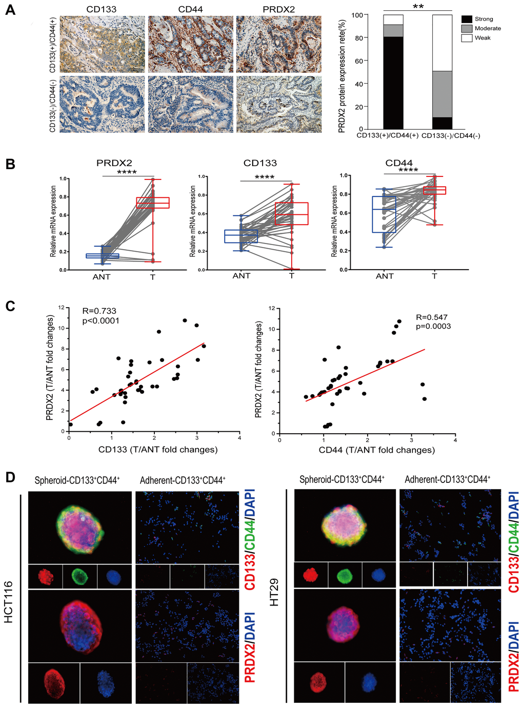 The critical role of peroxiredoxin-2 in colon cancer stem cells 