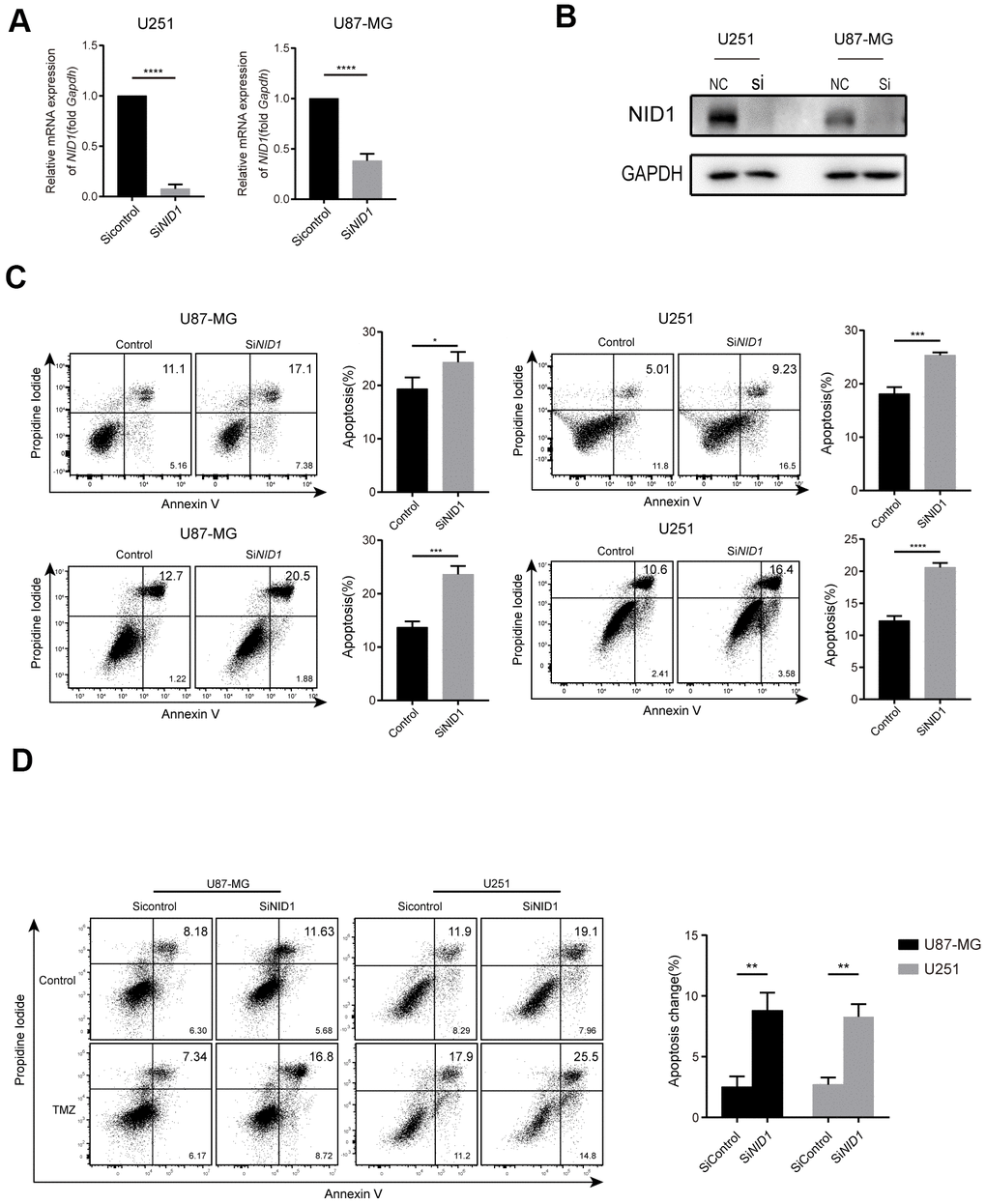 NID1 silencing in U87-MG and U251 glioma cells enhanced apoptosis and sensitivity to TMZ. (A) QRT-PCR analysis shows NID1 mRNA levels in si-NID1- and si-NC-transfected U251 and U87-MG glioma cell lines. (B) Representative western blot shows NID1 protein levels in si-NID1- and si-NC-transfected U251 and U87-MG glioma cell lines. (C) Representative FACS plots and histograms show percentage apoptosis in si-NID1- and si-NC-transfected U251 and U87-MG glioma cells based on AnnexinV-FITC/PI staining. (D) Representative FACS plots and histograms show percentage apoptosis in si-NID1- and si-NC-transfected U251 and U87-MG glioma cells treated with or without TMZ. As shown, NID1 silencing improved temozolomide (TMZ) sensitivity in glioma cells. Note: * PP