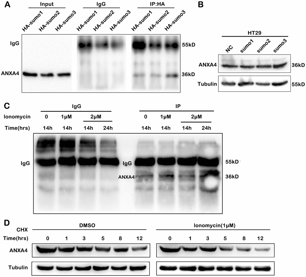SUMOylation of ANXA4 stabilized ANXA4 expression. (A) Immunoprecipitation analysis of ANXA4 SUMOylation after cells were cotransfected with flag-ANXA4 and HA-SUMO1, HA-SUMO2, or HA-SUMO3 and then subjected to western blotting with an anti-HA antibody. (B) Western blot analysis of ANXA4 proteins in HT-29 cells after transfection with HA-sumo1, HA-sumo2 or HA-sumo3. Tubulin was used as the loading control. (C) Immunoprecipitation analysis of ANXA4 SUMOylation after cells were cotransfected with flag-ANXA4 and HA-SUMO1, treated with the Ca2+ agonist ionomycin (1 μM or 2 μM) at 14 h and 24 h and then subjected to western blotting with an anti-HA antibody. (D) Western blot analysis of the expression of ANXA4 in HT-29 cells after treatment with cycloheximide with the addition of the Ca2+ agonist ionomycin (1 μM).