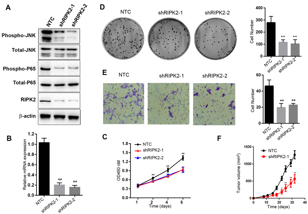 Knockdown of RIPK2 inhibit the 786-O cell proliferation, migration, colony formation and in vivo growth. (A) Western blot analysis of the 786-O cells stably transfected with control shRNA (NTC), or that targeting RIPK2 coding region (shRIPK2-1 and shRIPK2-2). (B) Quantitative PCR analysis of the RIPK2 mRNA level. Data are means ± SD (n=3), **pC) Cell proliferation results expressed in means ± SD (n=5), **pD) Colony formation assay photos (left) and quantitative results (right), Data are means ± SD (n=3), **pE) Migration result of 786-O cells, migrated cells were calculated and expressed with means ± SD (n=5), **pF) In vivo xenograft model of 786-O, the tumor volume was determined twice a week. Tumor volume was expressed in means ± SEM (n=5), **p