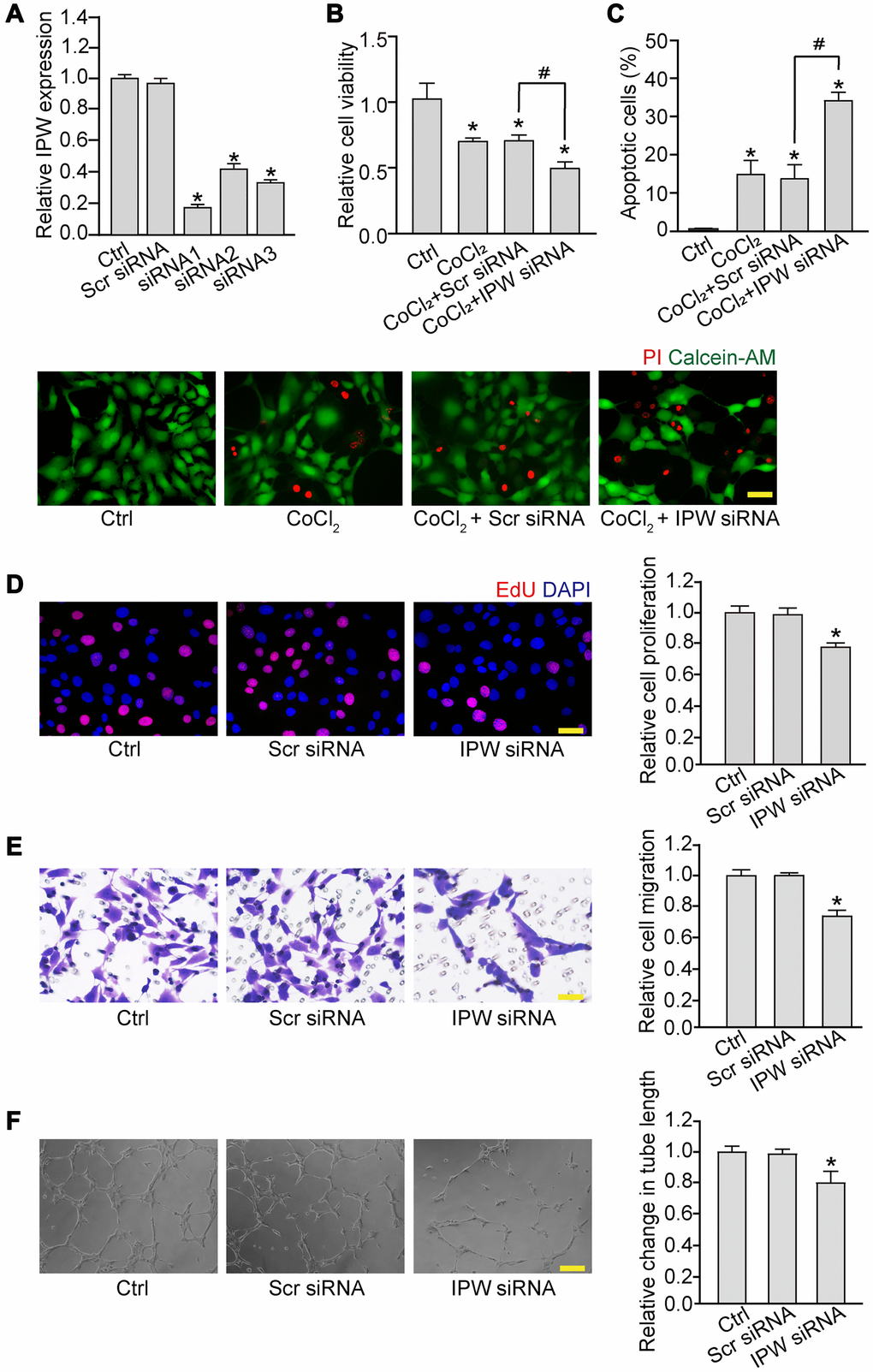Silencing of lncRNA-IPW reduces endothelial angiogenic function in vitro. (A) RF/6A cells were transfected with scrambled (Scr) siRNA, IPW siRNA, or left untreated (Ctrl) for 24 h. qRT-PCRs were performed to detect IPW expression (n = 4; *P B and C) RF/6A cells were transfected with Scr siRNA, IPW siRNA, or left untreated for 24 h, and then exposed with CoCl2 (200 μmol/L) to mimic hypoxic stress for 24 h. The group without CoCl2 treatment was taken as the Ctrl group. Cell viability was detected by MTT assays (B; n = 4; *P n = 4; *P #P 2 + IPW siRNA versus CoCl2 + Scr siRNA; One-way ANOVA). (D–F) RF/6A cells were transfected with Scr siRNA, IPW siRNA, or left untreated (Ctrl) for 24 h. Cell proliferation was determined by EdU incorporation assay. Blue: DAPI; red: EdU. Scale bar: 20 μm (D; n = 4; *P n = 4; *P n = 4; *P 
