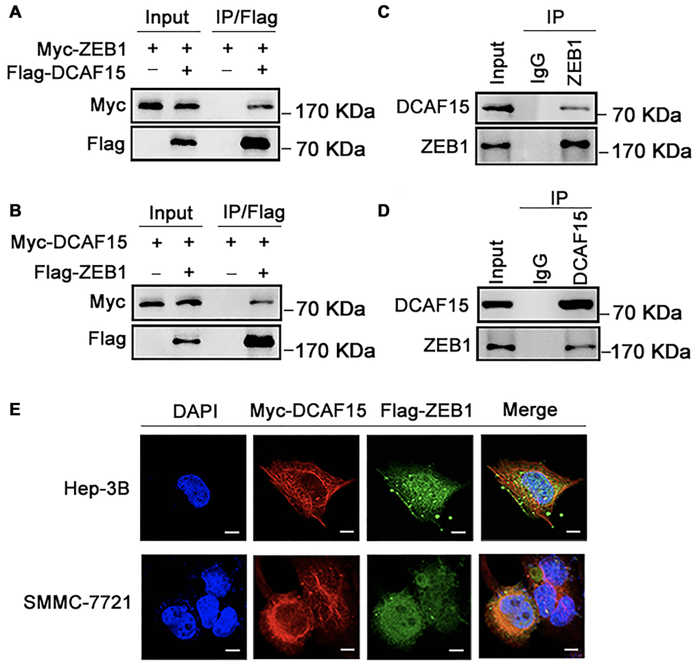 DCAF15 binds with ZEB1 protein. (A–B) Ectopically expressed DCAF15 and ZEB1 can bind with each other. (A) Flag-DCAF15 and Myc-ZEB1 were co-expressed in HEK293T cells, and immunoprecipitated with FLAG-M2 agarose beads. (B) Similar Co-IP assay was performed between Flag-ZEB1 and Myc-DCAF15. (C–D) Endogenous interaction between DCAF15 and ZEB1. (C) SMMC-7721 cells were treated with 10μM MG132 for 6h. Cell lysates were precipitated using anti-ZEB1 antibody or with IgG (mock IP) and coprecipitated DCAF15 was detected by western blotting. (D) SMMC-7721 cells were treated with 10 μM MG132 for 6h. Cell lysates were precipitated using anti-DCAF15 antibody or with IgG (mock IP) and coprecipitated ZEB1 was detected by western blotting. (E) Flag-DCAF15 and Myc-ZEB1 were co-expressed in Hep3B and SMMC-7721 cells respectively and visualized by fluorescence microscopy. Scale bars, 30 μm.