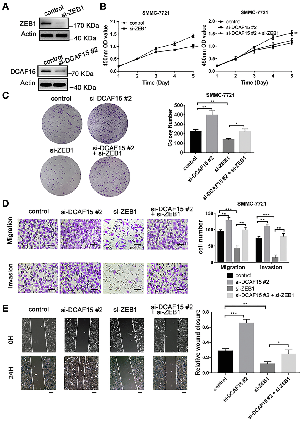 DCAF15 inhibits proliferation, migration, and invasion of HCC cells. (A) DCAF15 and ZEB1 was knocked down in SMMC-7721 cells by expressing siRNAs. Immunoblotting analyses were performed with the indicated antibodies. (B) CCK-8 assay was performed for cell proliferation of control, ZEB1-knockdown, DCAF15-knockdown and ZEB1-& DCAF15-knockdown SMMC-7721 cells. (C) The cells of (B) were plated and cultured on 6-well plates. Colony numbers were quantified. (D) The migration and invasion ability of the cells of (B) in were examined using the Transwell migration and invasion assay respectively. Cell numbers were quantified. Data are presented as mean ± SD (n = 3). **P ***P E) The cells of (B) were plated and cultured on 6-well plates. The cell layer was scratched with a 10 μl pipette tip. For each sample, at least three scratched fields were photographed immediately (0 h) or 24 h after scratching. Photographs of representative images were taken at ×100 magnification.