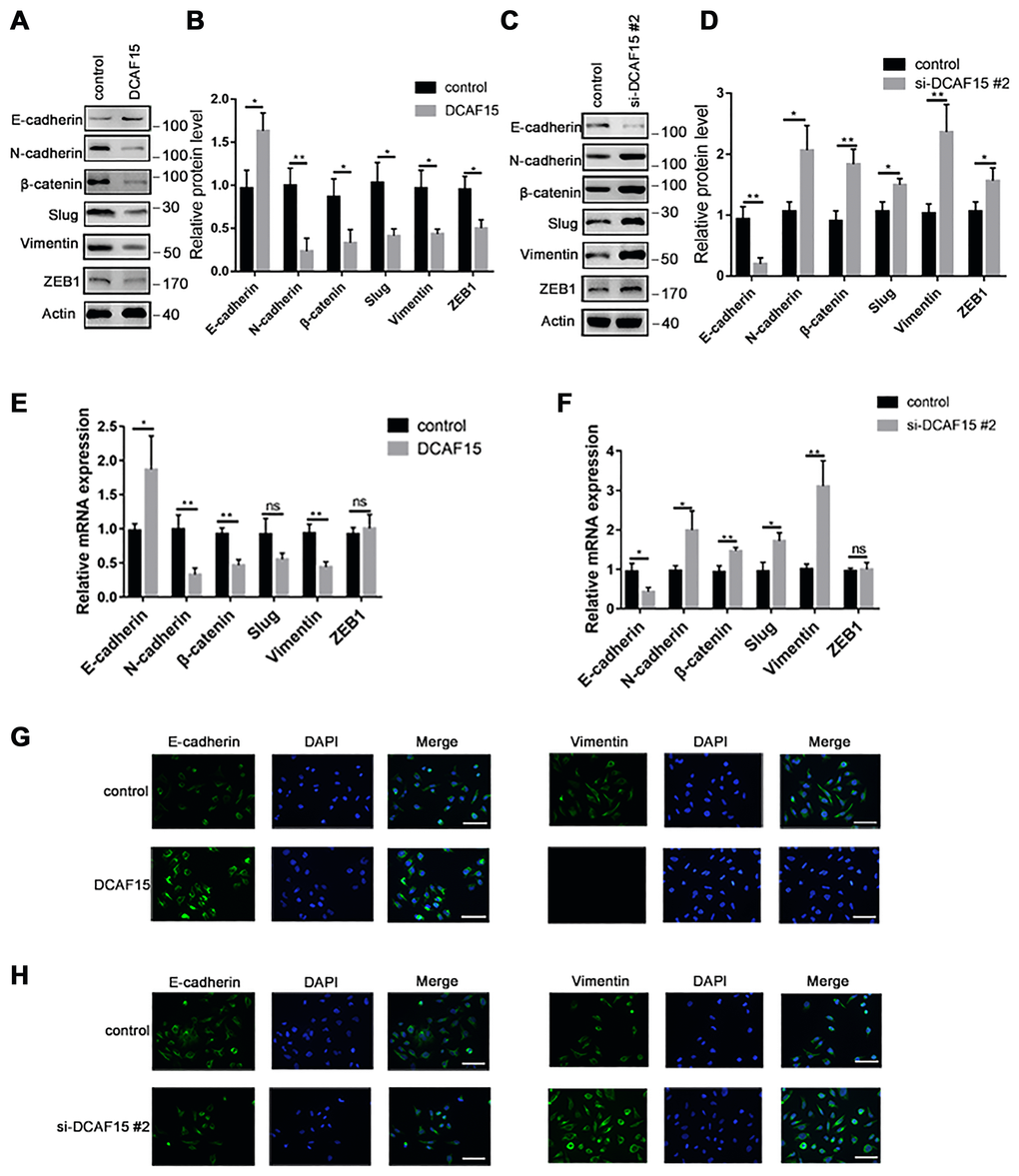 DCAF15 inhibits epithelial-mesenchymal transition (EMT) of HCC cells. (A–B) Western blot analysis showed the protein level of EMT markers after transfecting with control or DCAF15 overexpression plasmids in HCC cells. (C–D) Western blot analysis showed the protein level of EMT markers after transfecting with control or DCAF15 siRNA in HCC cells. (E) qRCR analysis showed relative mRNA level of EMT markers after transfecting with control or DCAF15 overexpression plasmids in HCC cells. (F) qRCR analysis showed relative mRNA level of EMT markers after transfecting with control or DCAF15 siRNA in HCC cells. (G) Protein level of E-cadherin and vimentin after transfecting with control or DCAF15 overexpression plasmids in HCC cells was visualized by fluorescence microscopy. Scale bars, 100 μm. (H) Protein level of E-cadherin and vimentin after transfecting with control or DCAF15 siRNA in HCC cells was visualized by fluorescence microscopy. Scale bars, 100 μm.