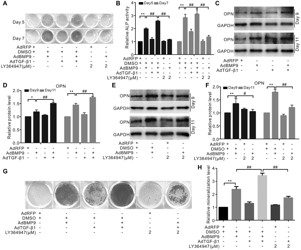 Effects of TGF-β1 on BMP9-induced osteogenic makers in C3H10T1/2 cells. (A) ALP staining shows the effect of TGF-β1 or LY364947 (TGF-βRI inhibitor) on the ALP activity induced by BMP9. (B) Quantification results of ALP assay show the BMP9-induced ALP activities was affected by TGF-β1 and/or LY364947. (C) Western blotting results show OPN was affected by TGF-β1. (D) Quantification results of western blot assay show OPN was affected by TGF-β1 and/or BMP9. (E) Western blotting analysis showed OPN level was affected by BMP9 and/or LY364947. (F) Quantification results of western blot assay show OPN was affected by BMP9 and/or LY364947. (G) Alizarin Red S assay shows mineralization was affected by TGF-β1, LY364947, and/or BMP9. (H) Quantification results of Alizarin Red S assay show that mineralization was affected by TGF-β1, LY364947, and/or BMP9. “**”p “#”p “##”p 