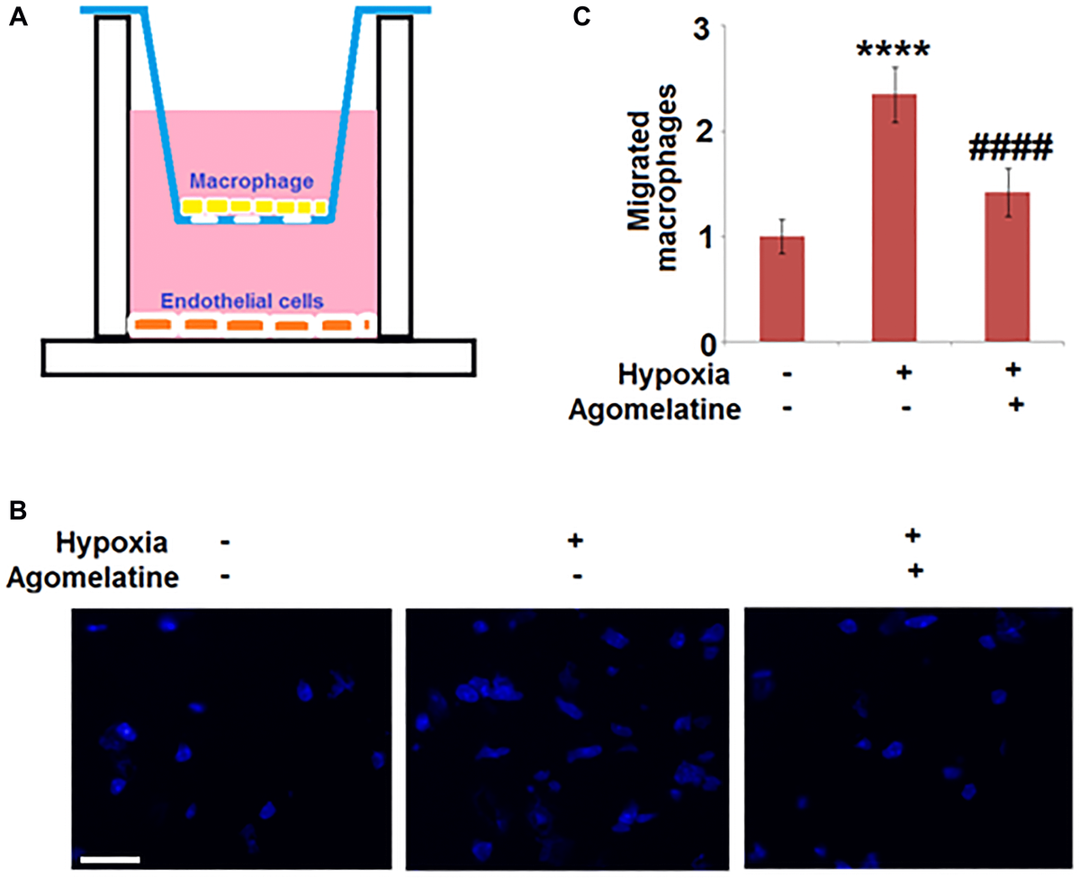 Aging Agomelatine Prevents Macrophage Infiltration And Brain Endothelial Cell Damage In A Stroke Mouse Model Figure F5