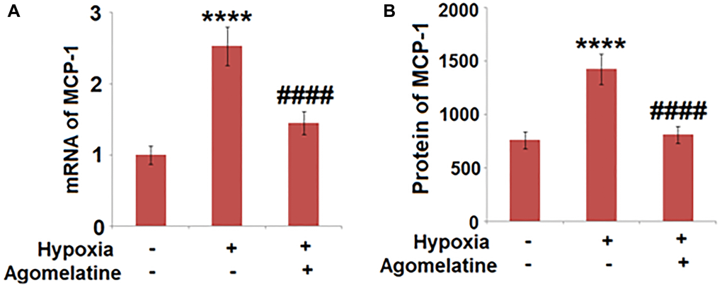 Agomelatine reduced the expression and secretion of MCP-1 in hypoxic endothelial cells. Brain bEnd.3 endothelial cells were incubated with 10 μM Agomelatine in the process of hypoxia/ reperfusion (H/R). (A). mRNA of MCP-1 was measured; (B). Secretions of MCP-1 were measured (****P ####P 