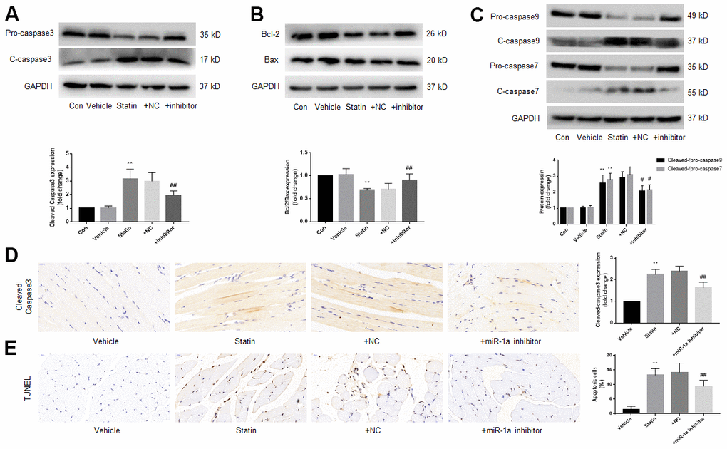 Downregulation of miR-1a expression inhibits the apoptosis of gastrocnemius muscle cells induced by statin in vivo. The protocol for animal experiments was shown in Figure 6A. (A–C) Expressional levels of pro-/cleaved-caspase3, 7, 9, bcl-2 and bax in gastrocnemius were assayed by western blot. (D) Cleaved-caspase3 in gastrocnemius were assayed by IHC. (E) Cell apoptosis in gastrocnemius was determined by TUNEL method. N is 10-15 in each group. **P #P##Ppost-hoc tests was used to determine P value in (A–E).