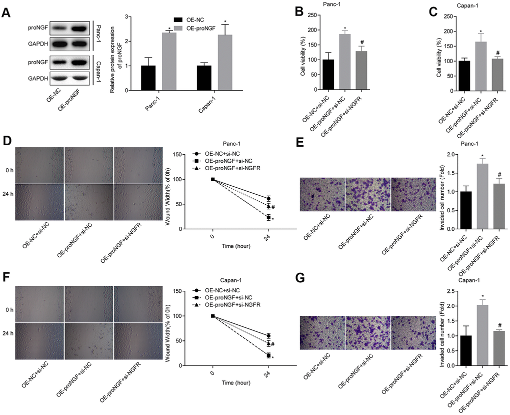 P75NTR plays a role in promoting cancer by combining with proNGF. (A) Level of proNGF after transfection. (B, C) Comparison of the cell viability in each group. (D, E) Comparison of the migration and invasion abilities of Panc-1 cells in different groups. (F, G) Comparison of the migration and invasion abilities of Capan-1 cells in different groups.