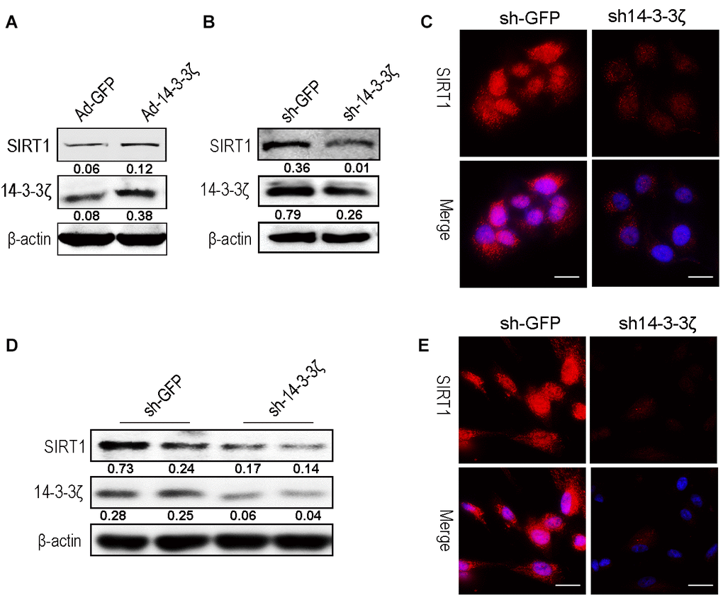 Knockdown the 14-3-3ζ inhibit SIRT1 expression in HaCaT and hucMSC cells. (A) Western blot analysis of SIRT1 expression level after HaCaT cells were transfected with containing the 14-3-3ζ sequence adenovirus expression vector. (B) Western blot analysis of SIRT1 expression level after HaCaT cells were transfected with containing the 14-3-3ζ sequence lentiviral expression vector. (C) Immunofluorescence detection of SIRT1 expression level after HaCaT cells were transfected with containing the 14-3-3ζ sequence lentiviral expression vector. (D) Western blot analysis of SIRT1 expression level after hucMSCs cells were transfected with containing the 14-3-3ζ sequence lentiviral expression vector. (E) Immunofluorescence detection of SIRT1 expression level after HaCaT cells were transfected with containing the 14-3-3ζ sequence lentiviral expression vector.