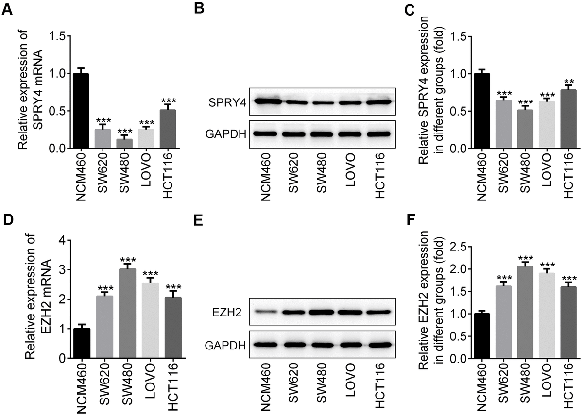 Spry Suppresses Proliferation And Induces Apoptosis Of Colorectal Cancer Cells By Repressing