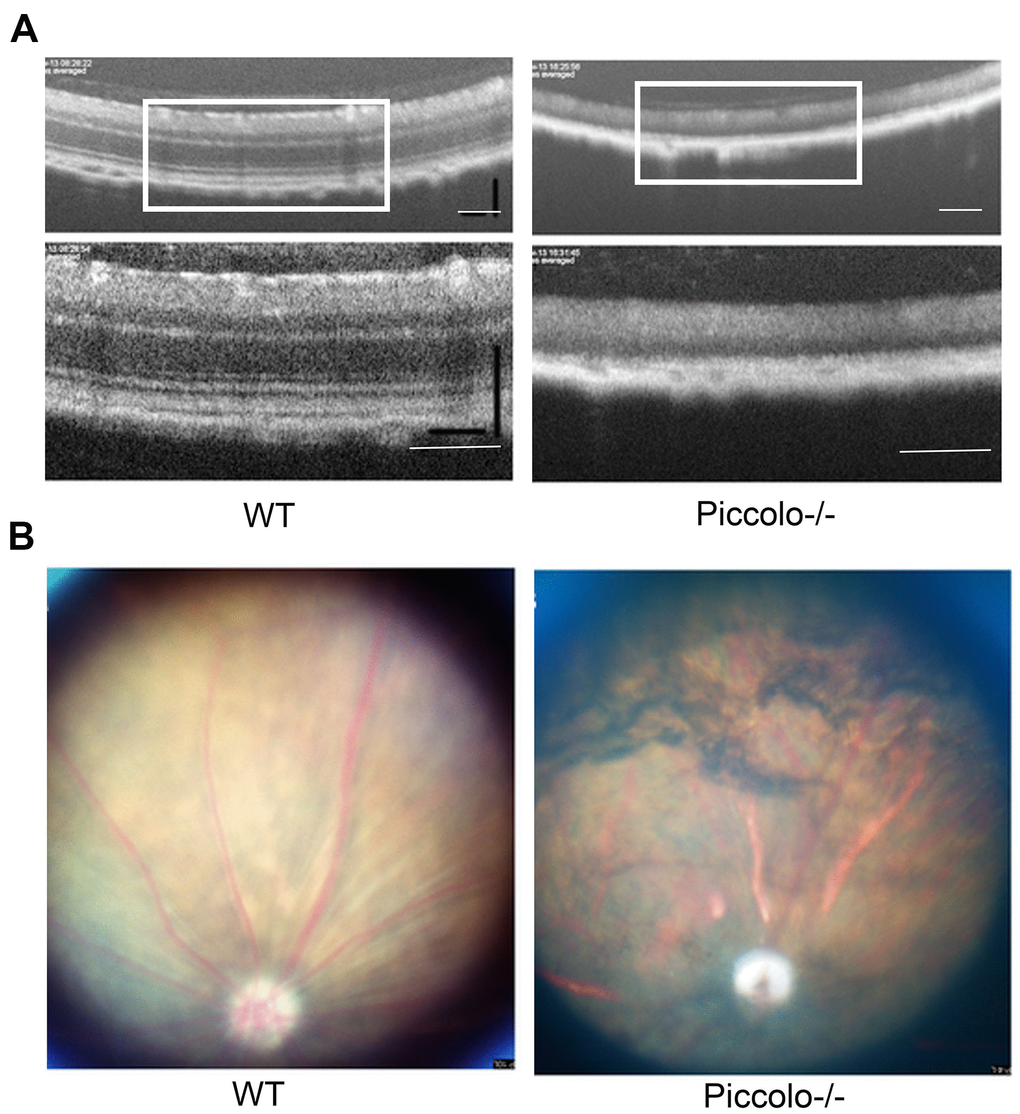 Examination of the retinal fundus in Piccolo-/- mice. (A) Optical coherence tomography (OCT) of the retina in Piccolo-/- mice compared with the wild type (WT) mice at P30; Scale bars: 100 μm. (B) Retinal fundus imaging in one-month-old WT and Piccolo-/- mice.