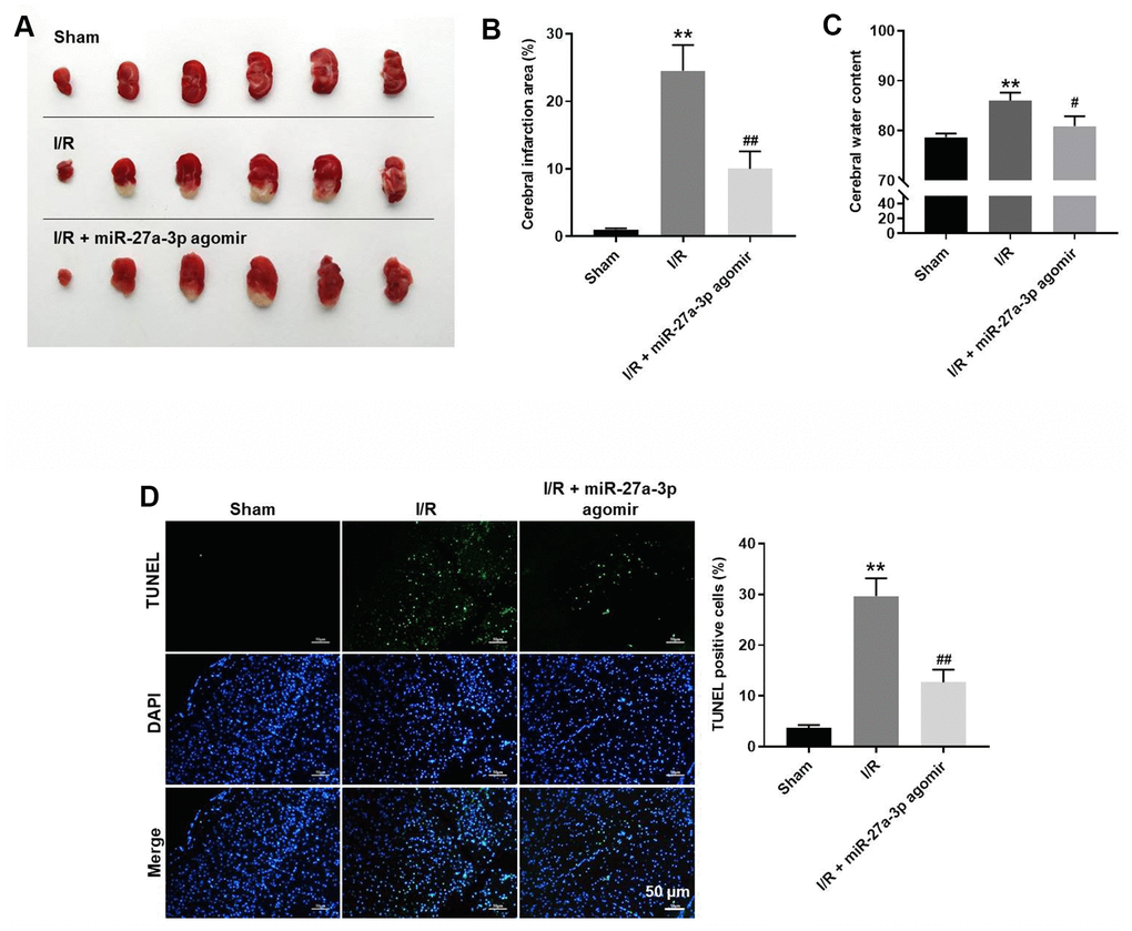 MiR-27a-3p agomir significantly alleviates the symptoms of CI/R in vivo. (A) Images of brain tissues from rats. (B) Calculated cerebral infraction area. (C) Cerebral water content. (D) TUNEL showing apoptosis within brain tissues. **P#P##P