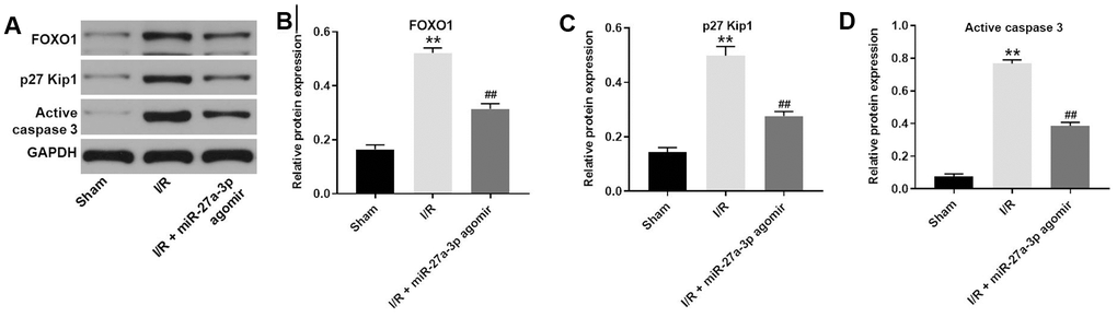 MiR-27a-3p agomir inhibits the expression of FOXO1, p27 Kip1 and active caspase 3 in brain tissues of rats. (A) Protein levels of FOXO1, p27 Kip1 and active caspase 3 in brain tissue from rats. (B–D) Relative expression levels of FOXO1 (B), p27 Kip1 (C) and active caspase 3 (D) normalized to GAPDH levels. **P##P