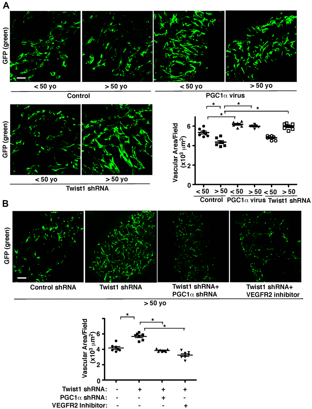 Twist1-PGC1α signaling mediates age-dependent decline in vascular formation in the subcutaneously implanted gel. (A) IF micrographs of fibrin gel supplemented with GFP-labeled young (50 years old) human adipose ECs treated with lentivirus overexpressing PGC1α or Twist1 shRNA and subcutaneously implanted on NSG mice for 7 days. As a control, young vs. aged human adipose ECs were treated with lentivirus encoding control shRNA with irrelevant sequences or vector alone. Scale bar, 100 μm. Graph showing vascular area in the gel (n=7, mean ± s.e.m., *, pB) IF micrographs of fibrin gel supplemented with GFP-labeled aged human adipose ECs treated with lentivirus encoding Twist1 shRNA or in combination with PGC1α shRNA or VEGFR2 inhibitor (SU5416) and subcutaneously implanted on NSG mice for 7 days. As a control, aged human adipose ECs were treated with lentivirus encoding control shRNA with irrelevant sequences or control vehicle. Scale bar, 100 μm. Graph showing vascular area in the gel (n=7, mean ± s.e.m., *, p