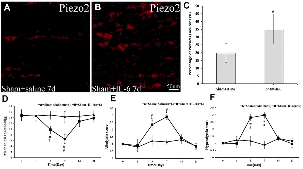 The Piezo2 expression after IL-6 administration in the sham rats. Immunocytochemistry images show the expression of Pieao2 in Sham+saline (A) and Sham+IL-6 group (B) at day 7, which accounts for 19.8±6.1% vs. 35.2±9.2% (pC). Three days after local administration of recombinant rat IL-6 in those with sham operation, significant changes in mechanical threshold (D) as well as dynamic allodynia score (E) and pinprick hyperalgesia score (F) are observed.