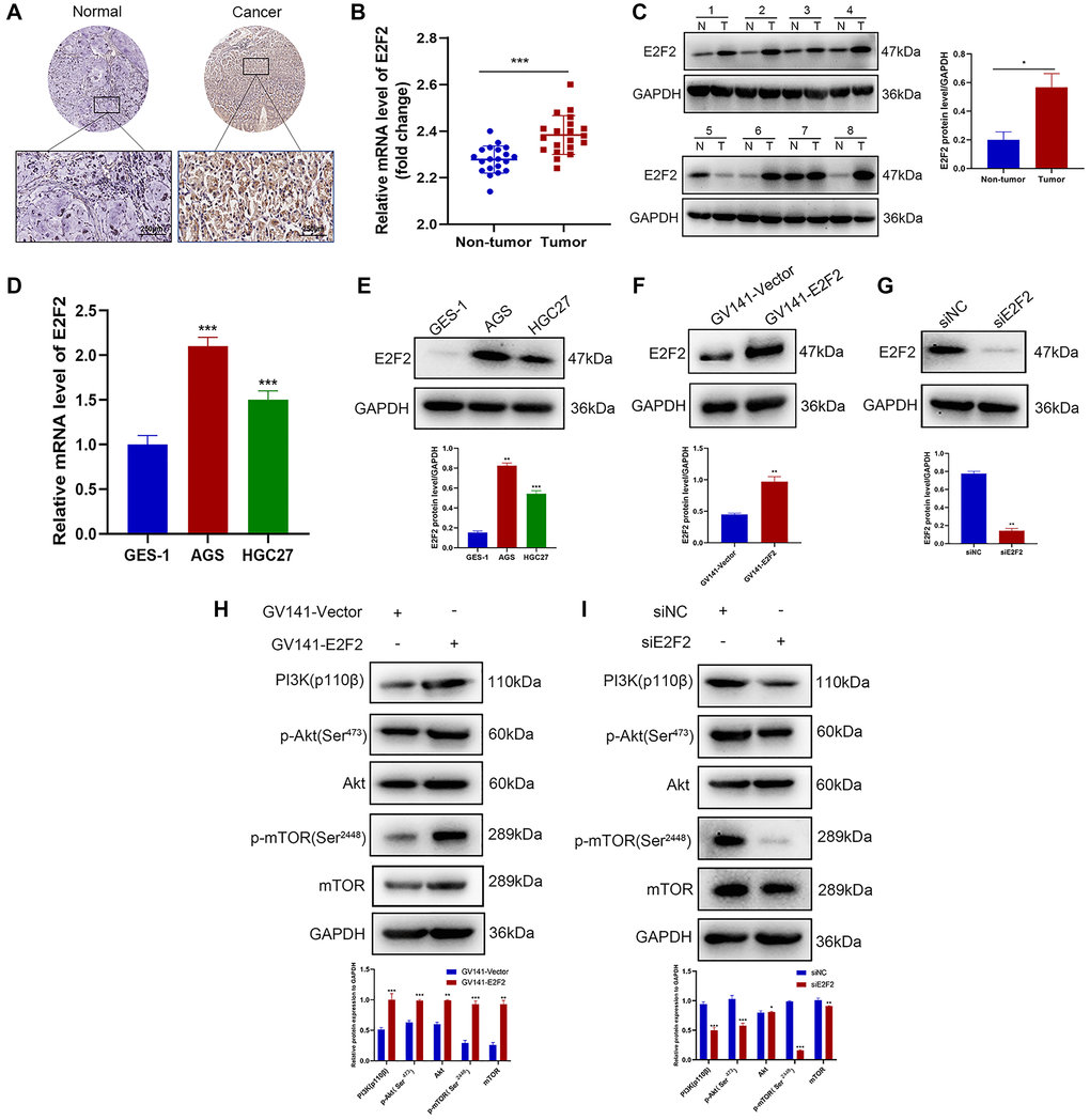 E2F2 is a regulator of the PI3K/Akt/mTOR pathway. (A) Representative images of E2F2 TMA analysis in GC tissues and adjacent tissues. Scale bar, 250 μm. (B) Quantitative PCR (qPCR) analysis of E2F2 mRNA expression in GC and nontumor gastric tissues in our patient cohort. E2F2 mRNA expression levels were normalized to glyceraldehyde 3-phosphate dehydrogenase (GAPDH) expression levels (n = 20 per group). (C) Western blotting analysis of E2F2 protein expression in GC (T) and nontumor gastric tissues (N). E2F2 protein expression levels were normalized to β-actin expression levels (n = 8 per group). (D) qPCR analysis of E2F2 basal mRNA expression in three cell lines. E2F2 mRNA expression levels were normalized to GAPDH expression levels. (E) Western blotting analysis of E2F2 basal protein expression in the three cell lines; β-actin was used as a loading control. (F) Western blotting analysis of E2F2 protein expression in HGC27 cells transfected with GV141-Vector or GV141-E2F2 for 24 h. β-actin was used as a loading control. (G) Western blotting analysis of E2F2 protein expression in AGS cells transfected with siE2F2 for 24 h. β-Actin was used as a loading control. (H) Western blotting analysis of PI3K 110β, p-AKT, AKT, p-mTOR, and mTOR protein expression in HGC27 cells transfected with GV141-Vector or GV141-E2F2 for 24 h. β-Actin was used as a loading control. (I) Western blotting analysis of PI3K 110β, p-AKT, AKT, p-mTOR and mTOR protein expression in AGS cells transfected with siNC or siE2F2 for 24 h. β-Actin was used as a loading control. Data are presented as the mean ± S.D. from three independent experiments. *P **P ***P 