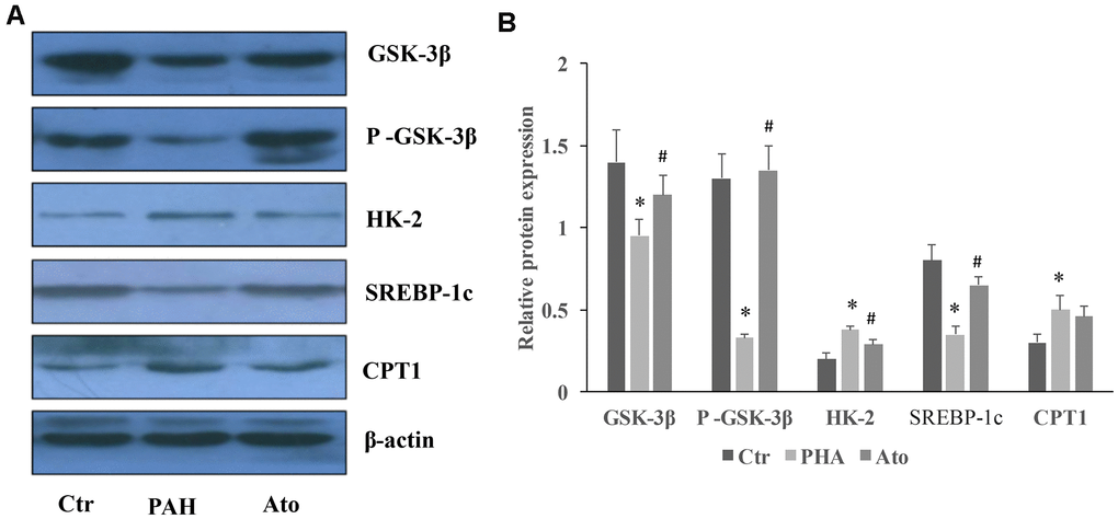 Influence of Ato on the protein levels of GSK-3β, HK-2, SERBP-1c, and CPT-1 in the lung tissues. (A) The protein levels in the lung tissues of Ato treated rats was measured using western blotting; (B) The protein expression was quantified.