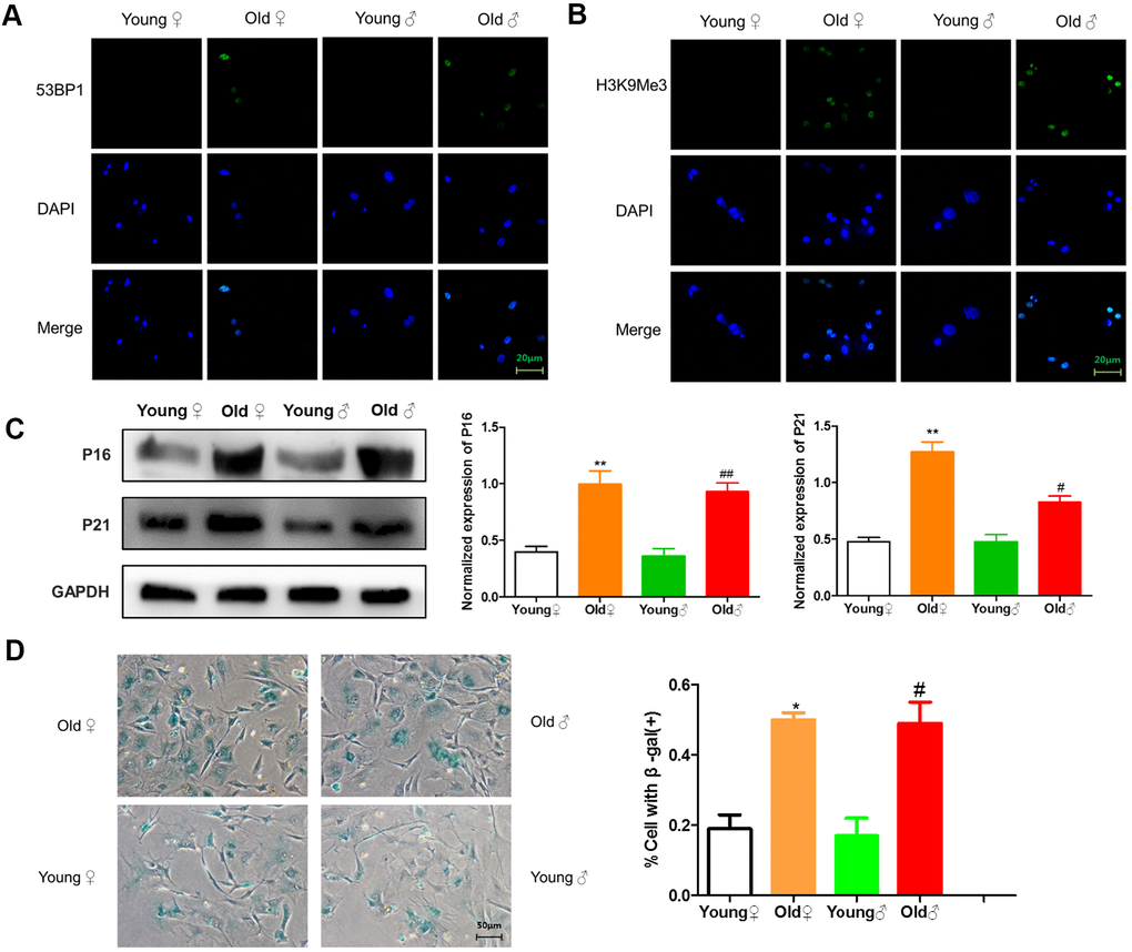 Senescence identification of osteocytes in aged and young rats. (A) 53BP1 immunofluorescence staining of aged rat and young rat osteocytes; (B) H3K9Me3 immunofluorescence staining of aged rat and young rat osteocytes; (C) Senescence marker protein assay and protein relative expression statistics of aged rat and young rat osteocytes (x¯±s,n=3); (D) β-Galactosidase staining of aged rat and young rat osteocytes and statistical plots of the percentage of positive β-galactosidase staining cells (x¯±s,n=3); *P #P ##P 