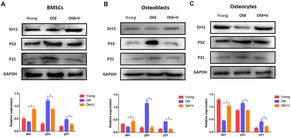 Changes in the SIRT1/p53/p21 axis in osteogenic cells after LMV. (A) BMSCs were treated with LMV and were harvested to detect the protein levels of SIRT1, p53, and p21 using western blotting (x¯±s,n=3); (B) Osteoblasts were treated with LMV and were harvested to detect the protein levels of SIRT1, p53, and p21 using western blotting (x¯±s,n=3); (C) Osteocytes were treated with LMV and were harvested to detect the protein levels of SIRT1, p53, and p21 using western blotting (x¯±s,n=3). *P 