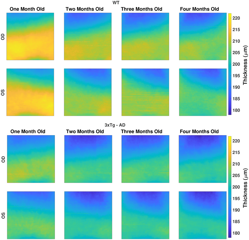 The average total retina thickness map (in μm) for both WT (top) and 3×Tg-AD group (bottom), separated by eye (rows), right (OD) and left eyes (OS), and by age (columns). The color range is consistent for all maps.