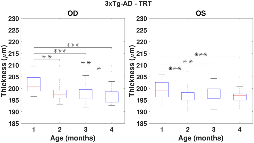 Boxplot of the total retinal thickness (TRT) (in μm) for each time point, for right (OD) and left (OS) eyes of 3×Tg-AD mice (respectively, left and right graphs). One, two and three asterisks represent, respectively, statistically significant differences at the level of 5%, 1% and 0.1%, based on pairwise comparisons. No statistically significant differences were found when comparing right to left eyes at any time point.