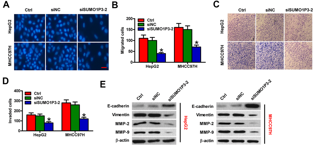 SUMO1P3 knockdown inhibited HCC cell migration and invasion in vitro. MHCC97H and HepG2 cells were untransfected (control) or transfected with siSUMO1P3 or siNC. Transwell assays were performed to evaluate the migration (A) and invasion (C) of MHCC97H and HepG2 cells. 40 × magnification in (C). The numbers of migrated (B) and invaded (D) cells were calculated. (E) The expression of E-cadherin, vimentin, MMP-2, and MMP-9 was analyzed via Western blot. β-actin was used as endogenous control. All data are represented as the mean ± SD of three replicates. *P 