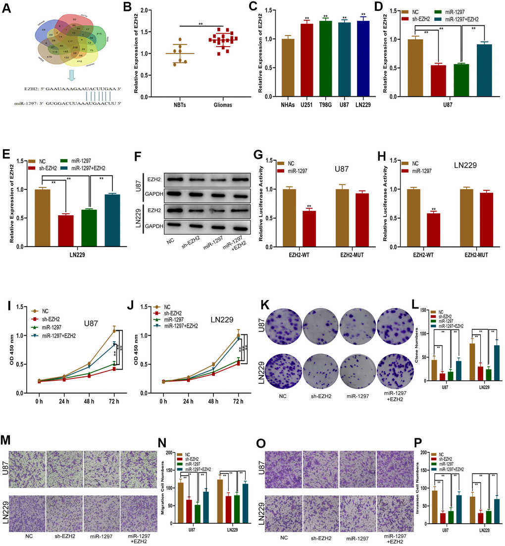 MiR-1297 inhibited proliferation, migration and invasion in glioma cells by targeting EZH2. (A) EZH2 was predicted as a target of miR-1297 through online bioinformatic databases. (B) Expression of EZH2 in normal tissues (n=7) and glioma tissues (n=17). (C) Expression of EZH2 in normal human astrocytes and glioma cell lines based on qRT-PCR. (D–F) qRT-PCR and western blotting showing the expression of EZH2 in glioma cell lines transfected with NC, sh-EZH2, miR-1297 or miR-1297 together with the EZH2 plasmid. (G, H) Luciferase reporter assays showed that miR-1297 reduced the luciferase activity of EZH2-WT but not of EZH2-MUT. (I, J) CCK-8 assays showing the proliferative capacity of glioma cell lines transfected with NC, sh-EZH2, miR-1297 or miR-1297 together with the EZH2 plasmid. (K, L) Colony formation assays showing the proliferative capacity of glioma cell lines transfected with NC, sh-EZH2, miR-1297 or miR-1297 together with the EZH2 plasmid. (M–P) Transwell assays showing the migration and invasion of glioma cell lines transfected with NC, sh-EZH2, miR-1297 or miR-1297 together with the EZH2 plasmid. *p 