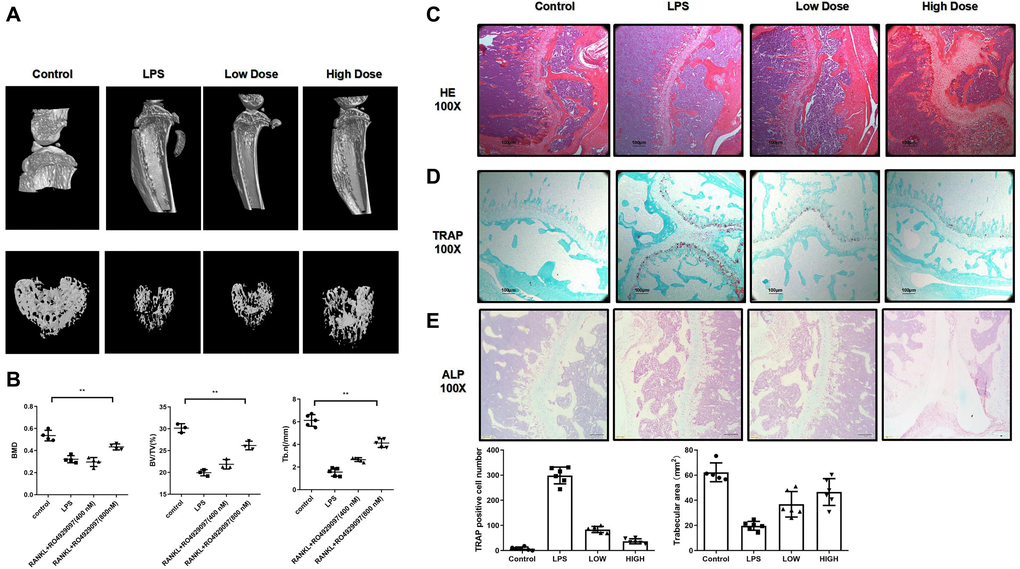 RO4929097 attenuated lipopolysaccharide-induced bone resorption in mouse knees in vivo. (A) Images of a three dimension reconstruction based on micro-CT scanning. (B) Results of BMD, bone BV/TV and Tb.n. (C, D and E) HE TRAP and ALP results. Amount of TRAP-positive OCs. The data are presented as the mean ± SD (*p **p ***p 