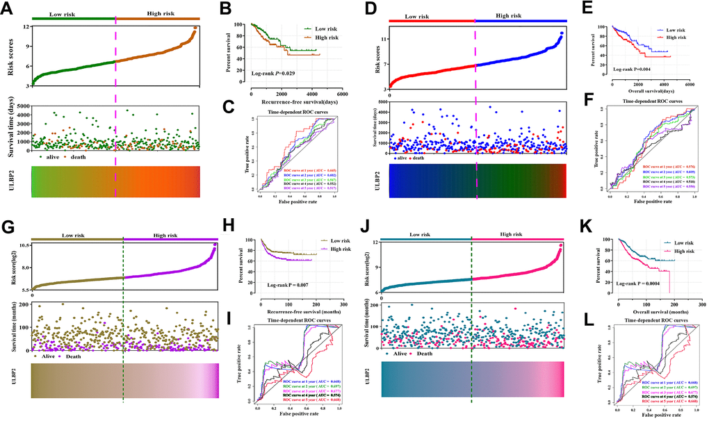 Prognostic risk score model and time-dependent ROC curve of ULBP2 gene in COAD and CC RFS and OS based on TCGA cohort and GSE40967 cohort. (A, D) Risk score model plot including risk score ranking, survival status, and heatmaps in COAD in COAD RFS and OS; (B, E) Kaplan–Meier curves for low- and high-risk groups in COAD RFS and OS; (C, F) ROC curves for 1-, 2-, 3-, 4-, and 5-year survival rates from the risk score model in CC RFS and OS; (G and J) Risk score model plot including risk score ranking, survival status, and heatmaps in CC in CC RFS and OS; (H, K) Kaplan–Meier curves for low- and high-risk groups in CC RFS and OS; (I, L) ROC curves for 1-, 2-, 3-, 4-, and 5-year survival rates from the risk score model in CC RFS and OS. Notes: COAD: colon adenocarcinoma; CC: colon cancer; ULBP: unique long 16 (UL16)-binding protein; ROC, receiver operating characteristic; RFS, recurrence-free survival; OS, overall survival.