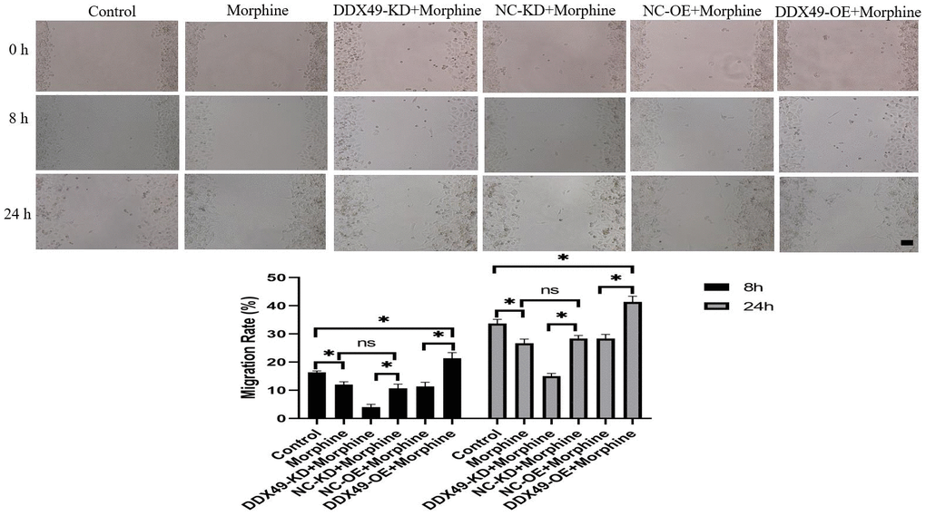 Effect of DDX49 on migration after HCC cells treat with morphine. Phase micrographs of migration HCC cells with DDX49 knock down or over expression in wound healing assay after exposure to morphine(10μM). Scale approximately 500 μm. Morphine QGY-7703 cells were treated with morphine (10μM) for 48h. *P 