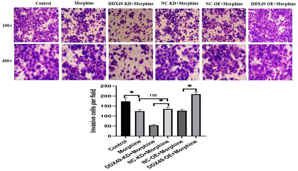Effect of DDX49 on invasion after HCC cells treat with morphine. Phase micrographs of invading HCC cells with DDX49 knock down or over expression in Matrigel invasion assay after exposure to control or morphine. Morphine QGY-7703 cells were treated with morphine (10μM) for 48h. *P 